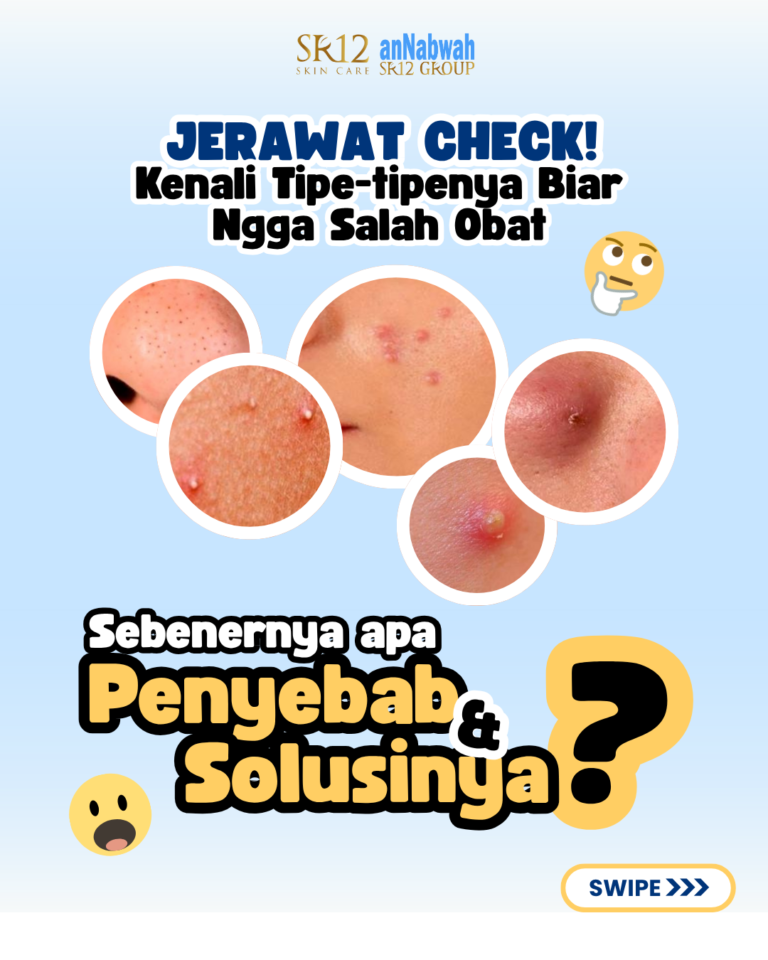 19 materi jerawat 1